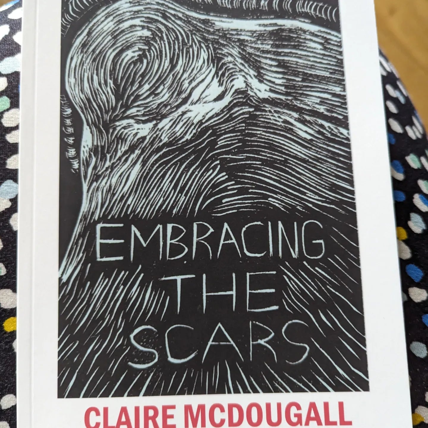 Embracing The Scars (book)