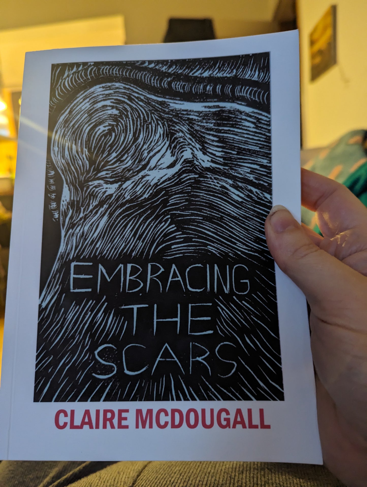 Embracing The Scars (book)